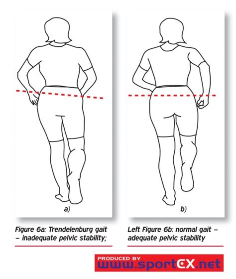 trendelenburg test vs hip drop test|positive trendelenburg sign in child.